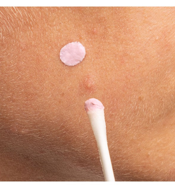 Naktinis serumas probleminei odai Mizon Good Bye Blemish 19ml